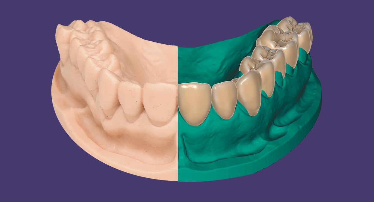 exocad image 5