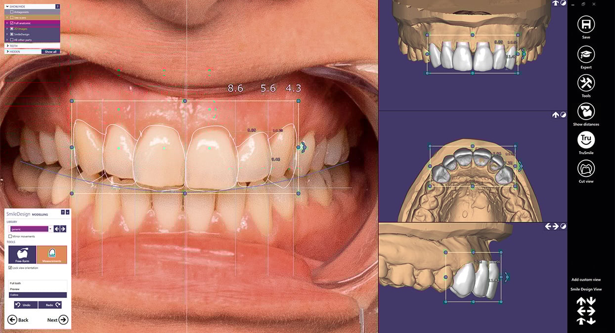 exocad image 1